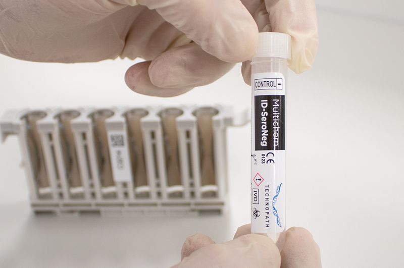 A technologist pipettes from Multichem IA Plus vial